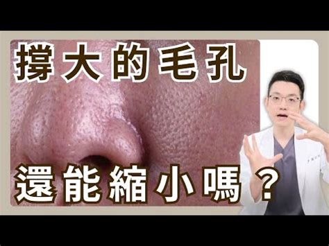 臉上白毛|臉長白毛位置暗示何事？